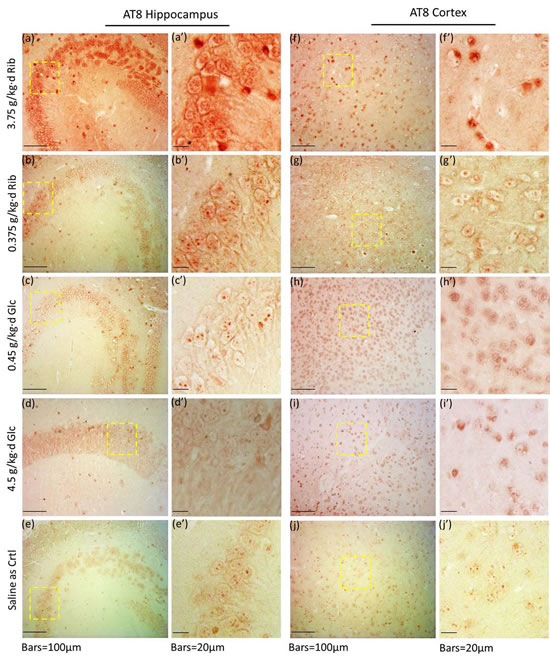 Immunohistochemical staining of AT8 in hippocampus and cortex.