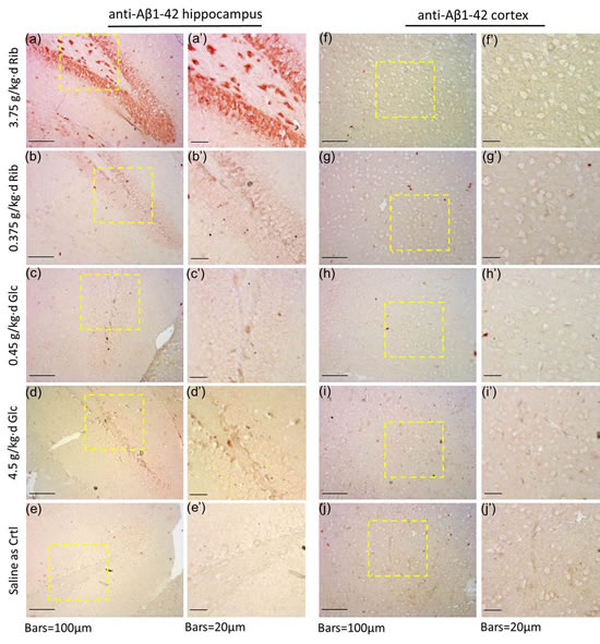 Immunohistochemical staining of A&#x3b2;-like deposits in hippocampus and cortex.