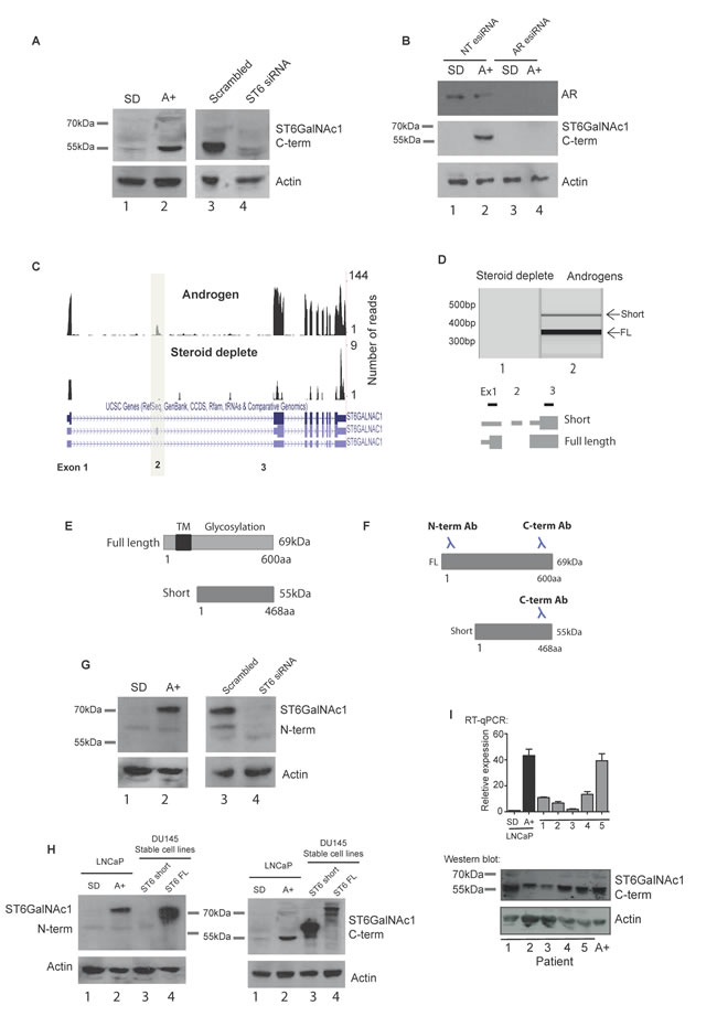 A novel alternative splice isoform of ST6GalNAc1 is expressed in response to androgen stimulation.