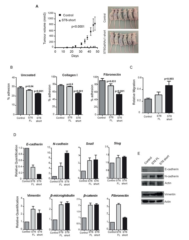 Expression of ST6GalNAc1 in PCa cells reduces adhesion, increases mobility and promotes transition towards a mesenchymal phenotype.