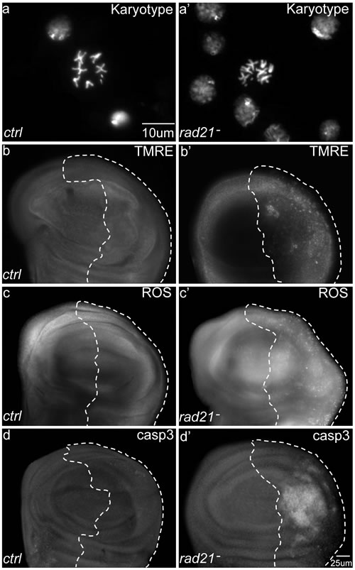 The effects of Chromosomal Instability (CIN) induced by Rad21 depletion on larval wing discs.