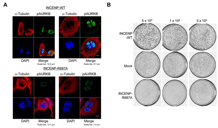 PRMT1-mediated methylation of INCENP at R887 is critical for proper mitotic progression of cancer cells.