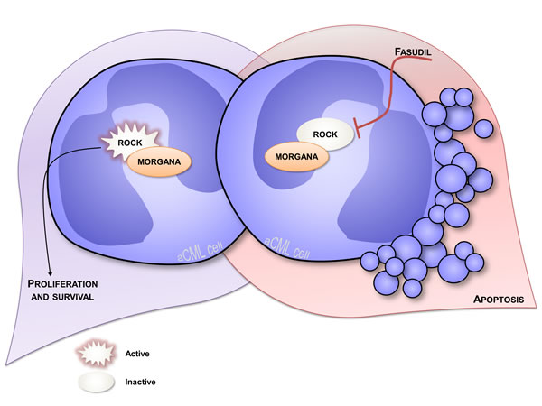 Overview of atypical CML.