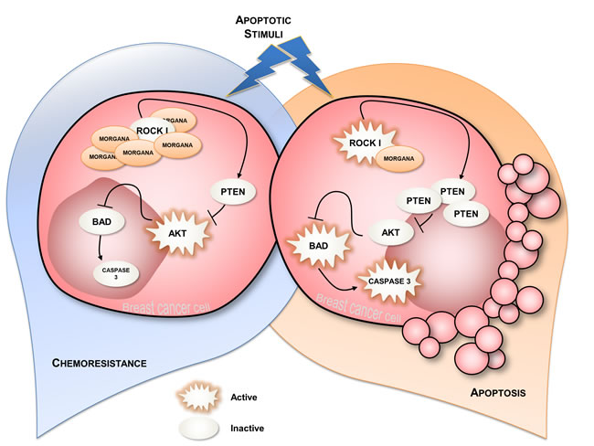 Schematic representation of Morgana normal and Morgana overexpressing breast cancer cells.