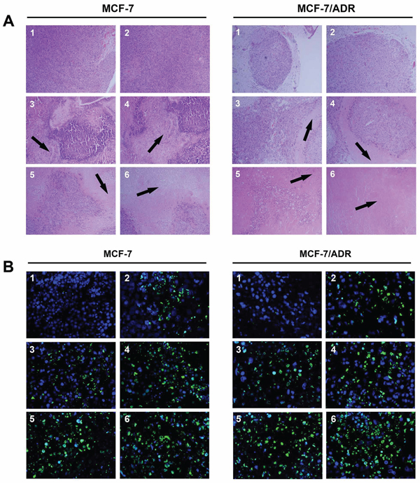 H &#x0026; E staining (A. &#x00D7; 100) and TUNEL analysis (B. &#x00D7; 400) of tumor tissues after treatment with various siRNA formulations.