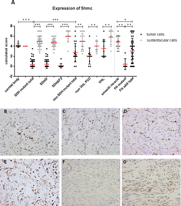 Loss of 5hmC expression in tumor cells of SDH and FH mutant tumors.
