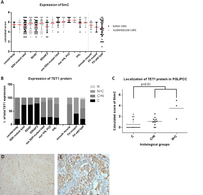 5mC and TET1 protein expression in SDH and FH mutant tumors.