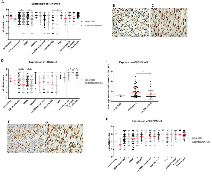 Expression of histone markers in SDH and FH mutant tumors.