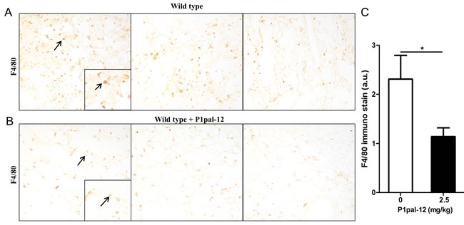 PAR-1 inhibition reduces macrophage numbers in the lung of bleomycin treated mice.