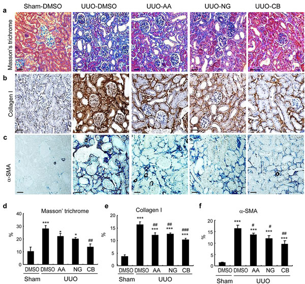 Histologic and immunohistochemical examination show that the combination treatment with AA and NG produces a better inhibitory effect on renal fibrosis in a mouse model of UUO.