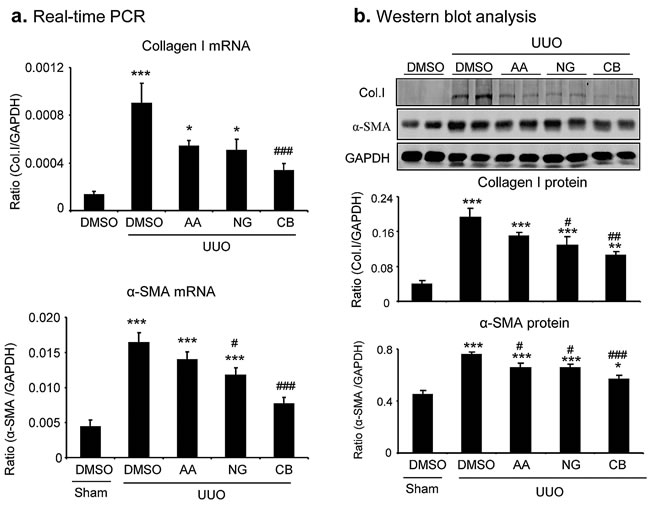 Real-time PCR and Western blot analysis detect that the combination treatment with AA and NG produces a better inhibitory effect on renal fibrosis in a mouse model of UUO.