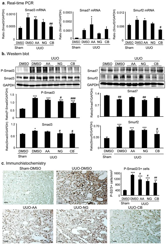 Combination treatment with AA and NG results in a further inhibition of TGF-&#x3b2;/Smad signaling in the UUO kidney.