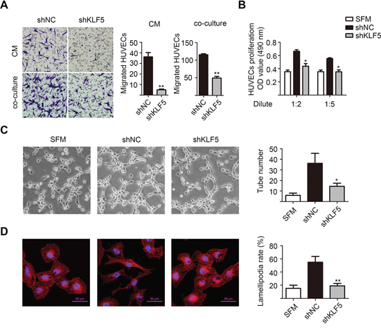 KLF5 is essential for the interaction between bladder cancer cells and HUVECs.