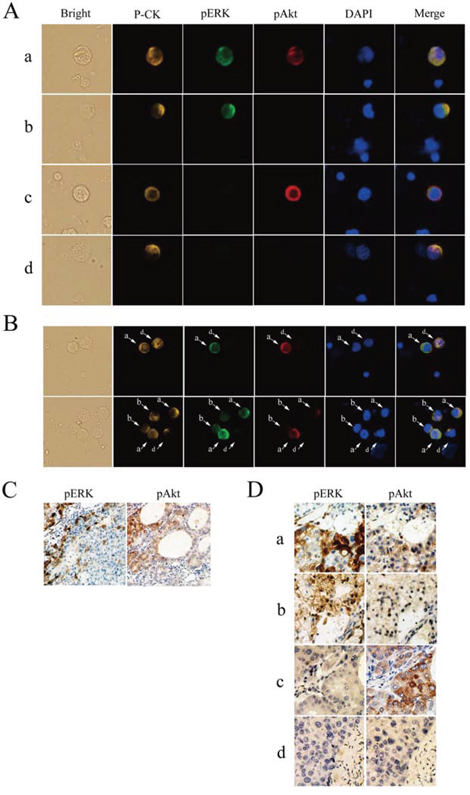 Detection of phosphorylated extracellular signal-regulated kinase (pERK) and protein kinase B (pAkt) in hepatocellular carcinoma.