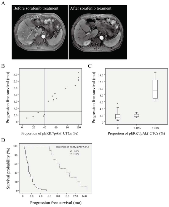 Survival curves for hepatocellular carcinoma patients.