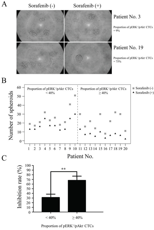 Sensitivity of circulating tumor cells (CTCs) to sorafenib.