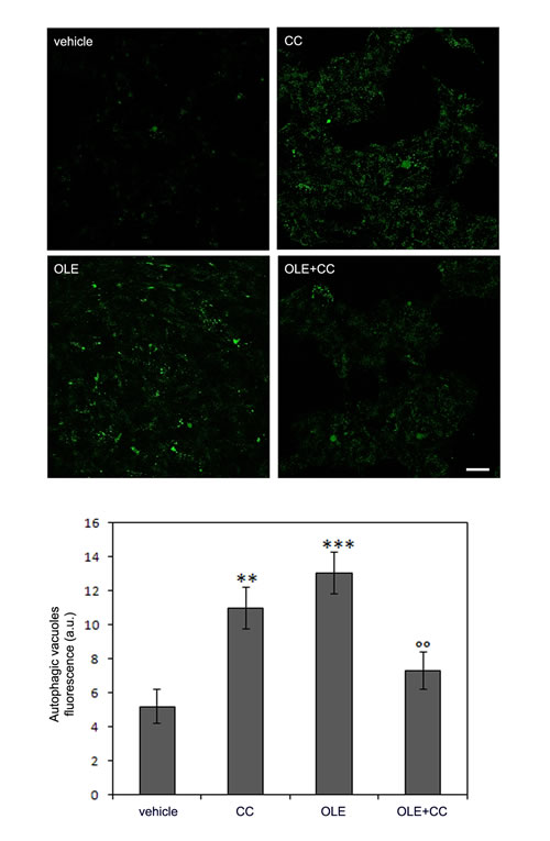 The AMPK inhibitor Compound C (CC) induces autophagy