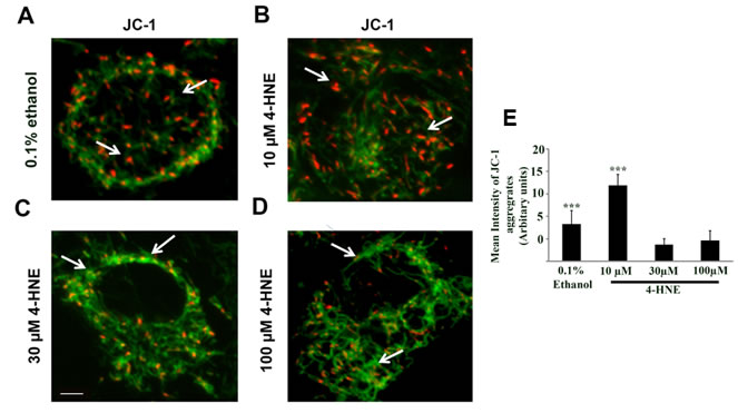 Assessment of mitochondrial dysfunction by JC-1 staining of 4-HNE treated SAECs.