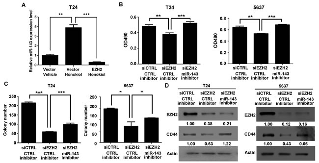 EZH2 gene regulated cell proliferation and clonogenicity through miR-143 in UBC cells.