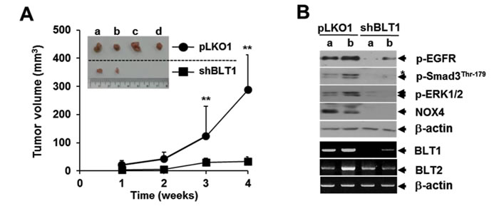 Lentivirus-mediated knockdown of BLT1 by shRNA inhibits the xenograft tumor growth of MDA-MB231 cancer cells in nude mice.