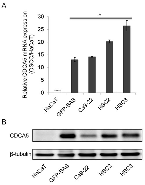 Overexpression of CDCA5 in human OSCC cells.