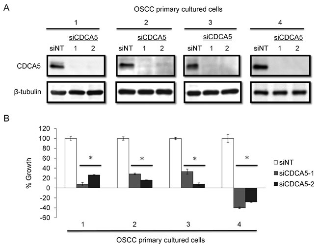Effect of targeting CDCA5 in human OSCC primary cell cultures.