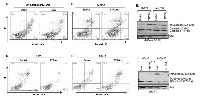 TTP does not induce apoptosis of breast tumor cells.