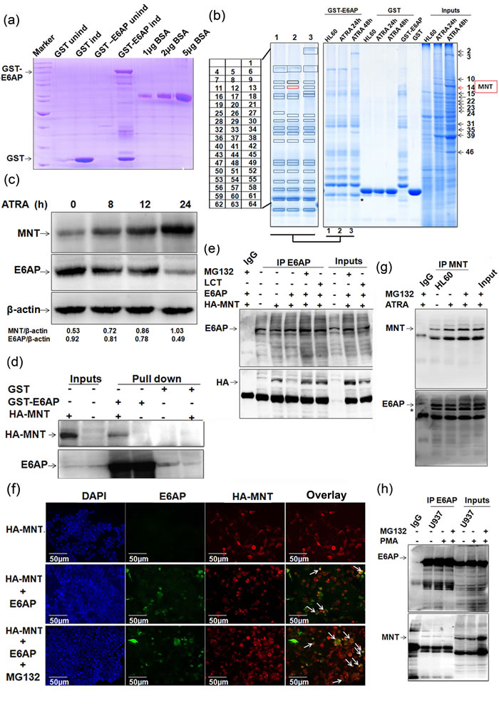 Figure1: MNT as a novel interacting partner of E6AP.