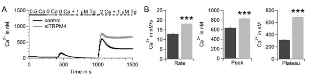 TRPM4 limits SOCE in hPEC.