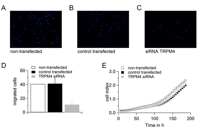 Down-regulation of TRPM4 leads to reduced migration potential of PC3 cells.