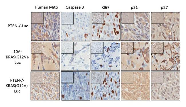 Immunohistochemistry of proliferative and cell cycle arrest markers in PTEN-/-, 10A-KRAS(G12V), and PTEN-/-KRAS(G12V) Representative images of immunostained samples for caspase 3, human mitochondria, Ki67, p21 and p27.