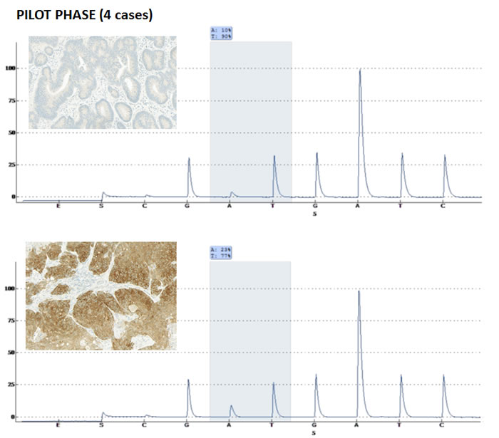 Four pre-selected cases of colorectal cancer with known mutational status for V600E (one wild-type and three mutated) were sectioned and the whole tissue slides stained for VE1.