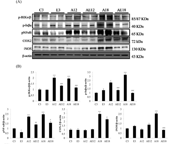 The representative inflammatory protein products extracted from the left ventricles of two rats in each group: control rats (C3), aging rats (A12, A18), and aging, exercise-trained rats (E3, AE12, AE18) were measured using Western blotting.