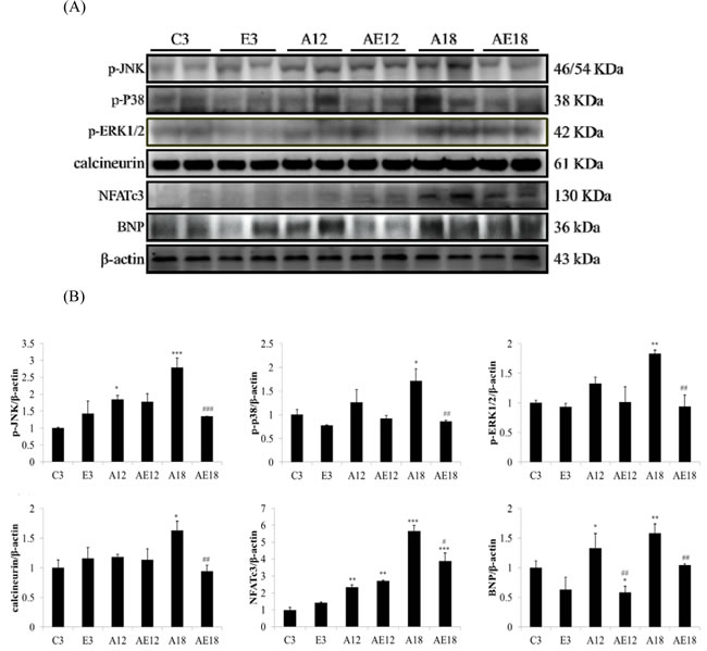 Representative hypertrophy protein products extracted from the left ventricles of two rats in each group: control rats (C3), aging rats (A12, A18), and aging, exercise-trained rats (E3, AE12, AE18) were measured using Western blotting.