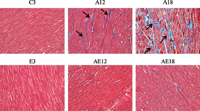 Masson&#x2019;s trichrome staining.