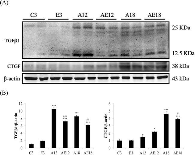 Representative protein products of the TGF&#x3b2;-dependent fibrosis pathway extracted from the left ventricles of two rats in each group: control rats (C3), aging rats (A12, A18), and aging, exercise-trained rats (E3, AE12, AE18) were measured using Western blotting.