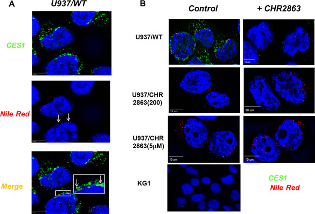 CES1 expression and identification of lipid droplets in U937/WT and CHR2863-resistant cells and CES1-lipid droplet co-localization.