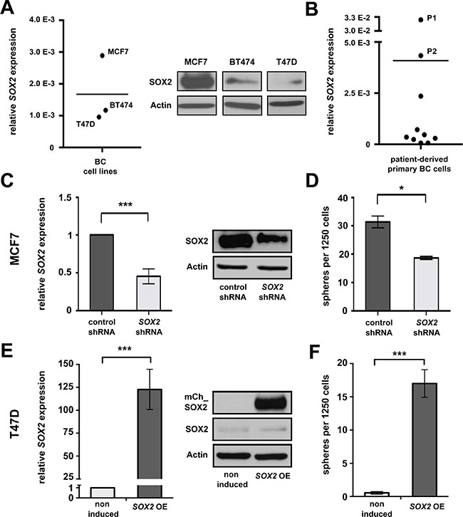 SOX2 is expressed in BC and promotes clonogenicity. (A)