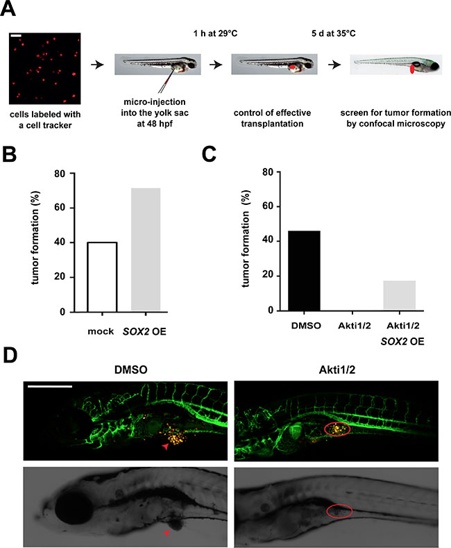 Influence of the AKT/SOX2 axis on in vivo tumorigenicity. (A)