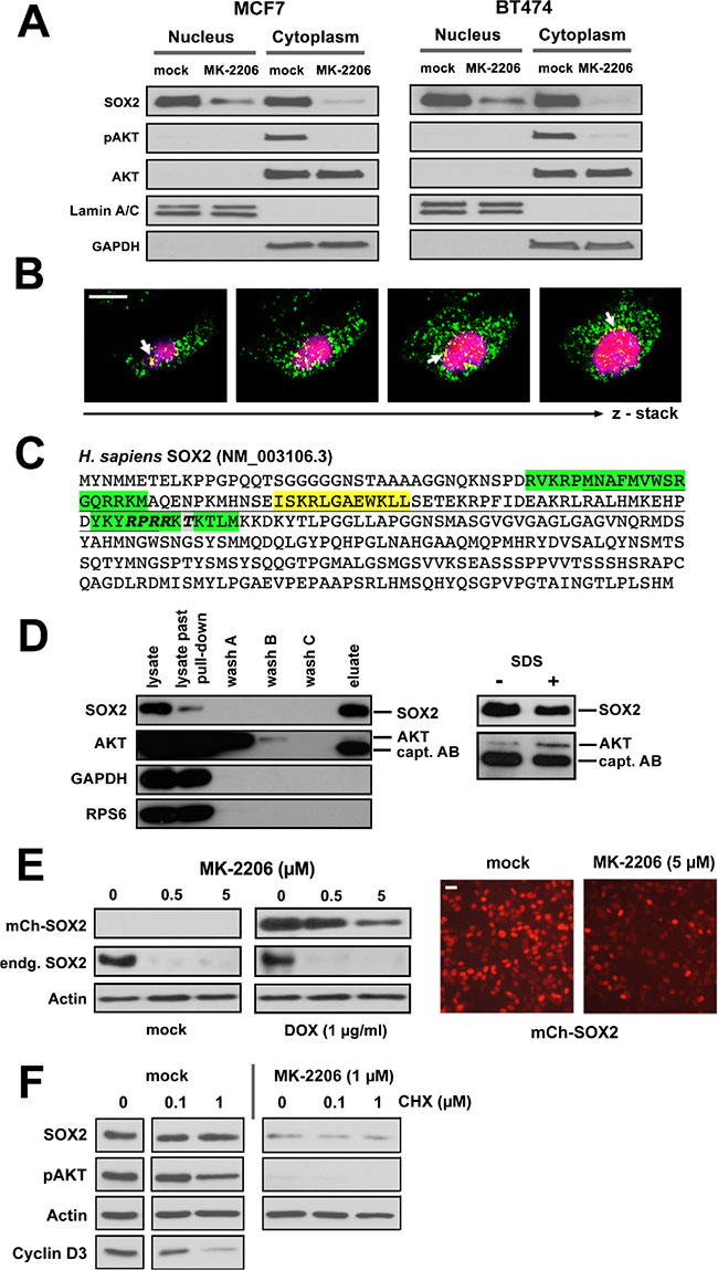 AKT and SOX2 proteins physically interact in BC cells. (A)