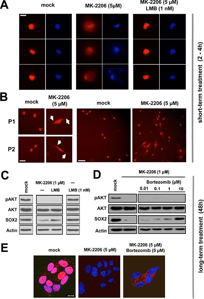 Proteasomal clearance of cytoplasmic SOX2 upon AKT inhibition. (A)