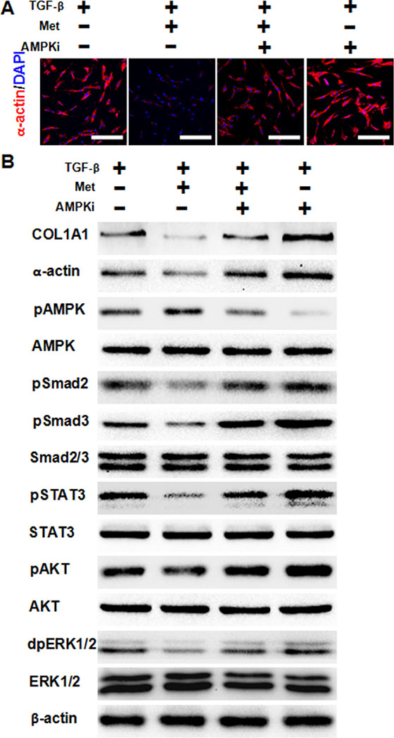 AMPK activation is required for metformin to attenuate TGF-&#x03B2;-induced fibrosis.