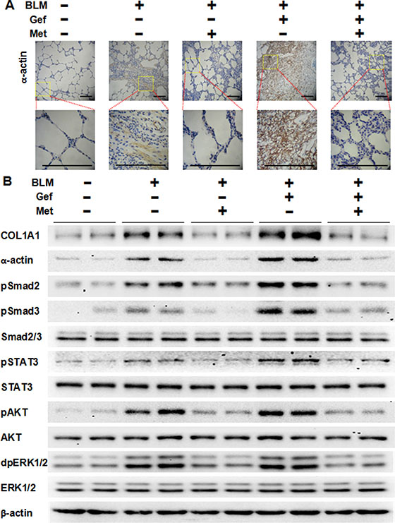 Metformin inhibits TGF-&#x03B2; signaling pathway in vivo.