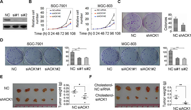 Silencing of ACK1 inhibits cell proliferation and colony formation