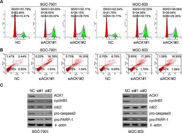 Knockdown of ACK1 induces G2/M arrest and cellular apoptosis in GC cells.