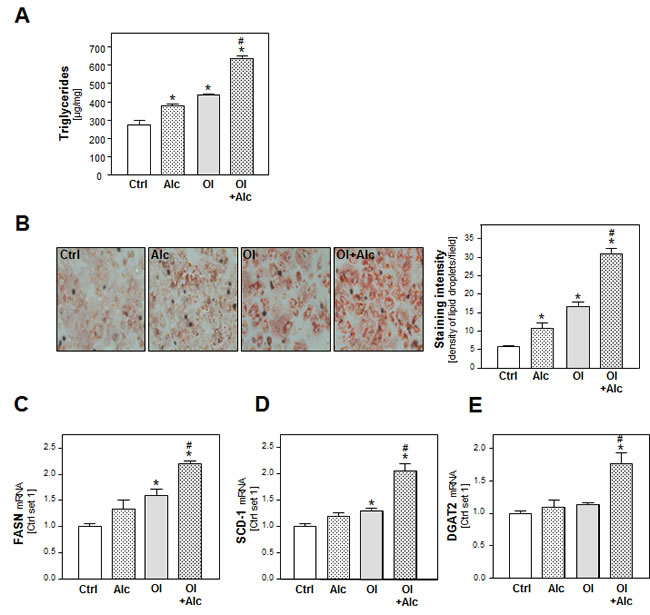 Analysis of the effect of alcohol and oleate on hepatocellular lipid metabolism and lipid accumulation.