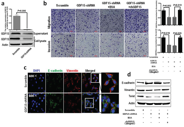 GDF15 knockdown in colorectal cancer cells inhibits EMT and metastasis.