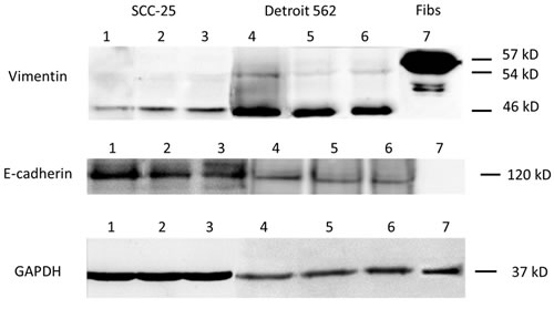 EMT-related protein synthesis in SCC-25 and Detroit 562 cells.