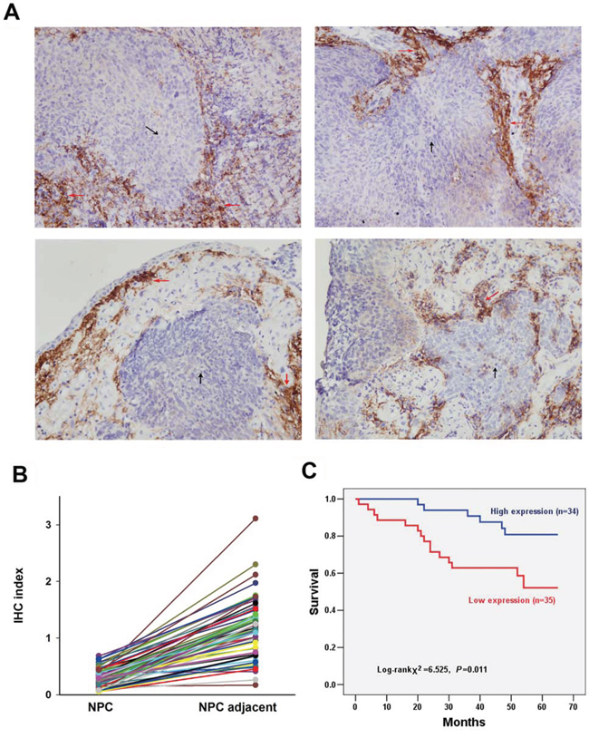 Detection of UbcH8 expression in NPC biopsies by immunohistochemistry.