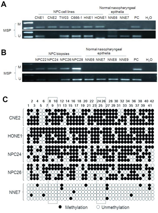 Methylation-specific PCR analysis of the UBE2L6 promoter region in NPC cell lines, NPC primary tumors and normal nasopharyngeal epithelium.